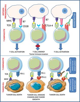 Immune Checkpoint Inhibitors: New Weapons Against Medullary Thyroid Cancer?